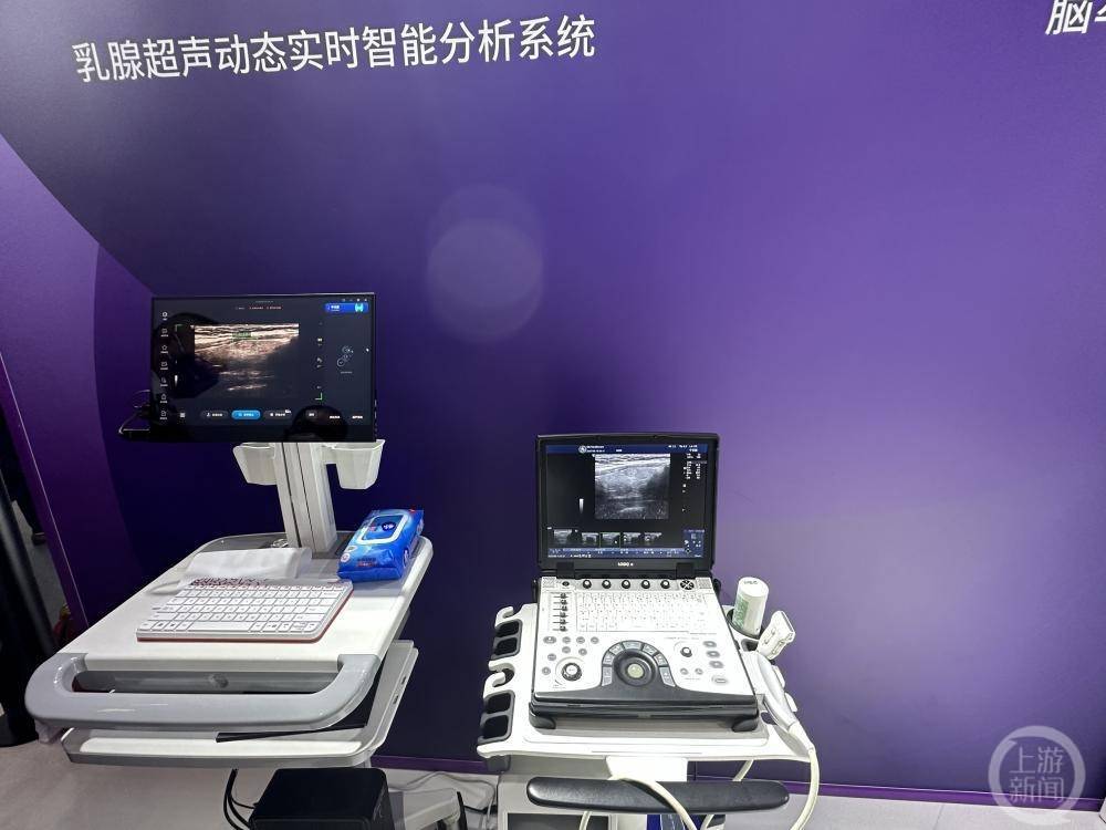 2023世界人工智能大会|AI技术赋能医疗,CT扫描时间可节约30% 2023世界人工智能大会|AI技术赋能医疗,CT扫描时间可节约30%