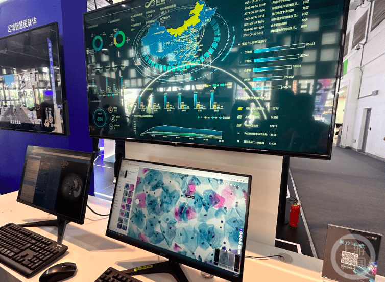 2023世界人工智能大会|AI技术赋能医疗,CT扫描时间可节约30% 2023世界人工智能大会|AI技术赋能医疗,CT扫描时间可节约30%